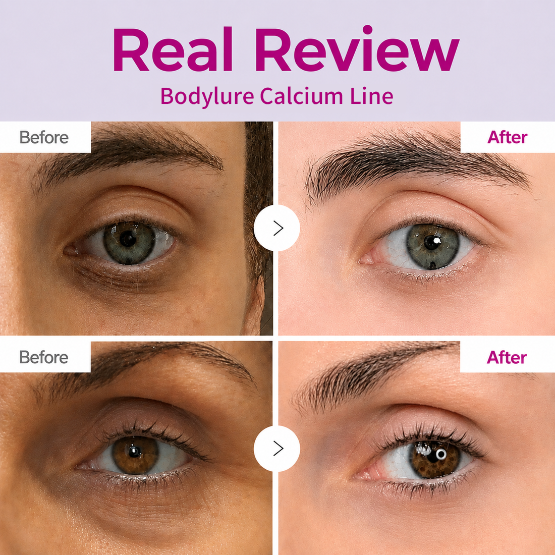🔥LAST DAY 50% OFF!!Cossetcare Korean Calcium Dark Spot Eye Cream